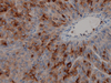 Alpha-1-Fetoprotein (AFP) - 760-2603 - Ventana Medical Systems, Inc.