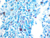 Ziehl Neelsen Method for Acid Fast Bacteria - mw009 - Poly Scientific