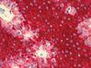ultraView Universal Alkaline Phosphatase Red Detection Kit - 760-501 - Ventana Medical Systems, Inc.