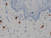 Tryptase - 760-4276 - Ventana Medical Systems, Inc.