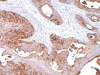 BG8, Lewisy - 760-4450 - Ventana Medical Systems, Inc.