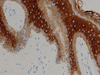 Cytokeratin (Pan) - 760-2595, 760-2135 - Ventana Medical Systems, Inc.