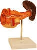 Diseased Pancreas with Duodenum and Spleen -- B10422 - Image