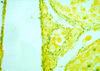 Dieterle Method for Spirochetes & Legionnaires` Disease - k010 - Poly Scientific
