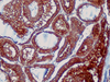Galectin-3 - 760-4256 - Ventana Medical Systems, Inc.