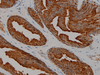 PSAP (Prostatic Acid Phosphatase) - 760-4272 - Ventana Medical Systems, Inc.