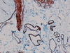 Actin, Alpha-Smooth Muscle - 760-2833 - Ventana Medical Systems, Inc.
