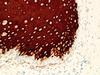 Cytokeratin 10 - 790-4562 - Ventana Medical Systems, Inc.