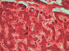 Orcein Stain for Elastic Fibers - k044 - Poly Scientific