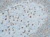 CONFIRM Vimentin - 760-2512 - Ventana Medical Systems, Inc.