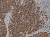 TdT (Terminal Deoxynucleotidyl Transferase) - 760-2670 - Ventana Medical Systems, Inc.