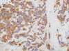 Synaptophysin - 760-4595 - Ventana Medical Systems, Inc.
