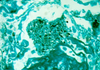 Grocott`s Method for Fungi (GMS) - k022 - Poly Scientific