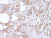 E-cadherin - 760-4440 - Ventana Medical Systems, Inc.