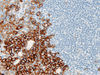 CD138 (Syndecan-1) - 760-4248 - Ventana Medical Systems, Inc.