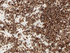 CD22 - 790-4588 - Ventana Medical Systems, Inc.