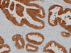 PSA (Prostate Specific Antigen) - 760-4271 - Ventana Medical Systems, Inc.