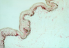 Fontana Masson Silver Method for Cytoplasmic Granules - k012 - Poly Scientific