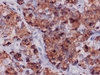 Human Growth Hormone (hGH) - 760-2804 - Ventana Medical Systems, Inc.