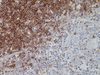 CD1a - 760-4525 - Ventana Medical Systems, Inc.