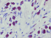 AFB III Staining Kit - 860-027 - Ventana Medical Systems, Inc.