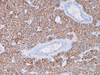 Parathyroid Hormone (PTH) - 760-4532 - Ventana Medical Systems, Inc.
