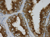 CONFIRM PSA (Prostate Specific Antigen) - 760-2506 - Ventana Medical Systems, Inc.