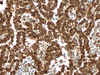 CONFIRM Calretinin - 790-4467 - Ventana Medical Systems, Inc.