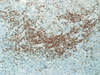 CD19 - 790-4587 - Ventana Medical Systems, Inc.