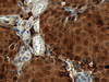 CONFIRM Thymidine Phosphorylase - 790-4454 - Ventana Medical Systems, Inc.