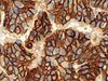 CONFIRM IGF-1 Receptor - 790-4346 - Ventana Medical Systems, Inc.