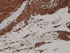 Actin, Muscle - 760-2502 - Ventana Medical Systems, Inc.