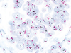 ultraView SISH DNP Detection Kit - 760-098 - Ventana Medical Systems, Inc.