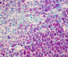 Kinyoun`s Method for Acid Fast Bacteria - k026 - Poly Scientific