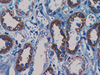 Renal Cell Carcinoma (RCC) - 760-4273 - Ventana Medical Systems, Inc.