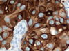 EMA (Epithelial Membrane Antigen) - 790-4463 - Ventana Medical Systems, Inc.