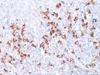IgD (Immunoglobulin D) - 760-4444 - Ventana Medical Systems, Inc.