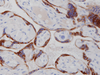 Inhibin, alpha - 760-2834 - Ventana Medical Systems, Inc.
