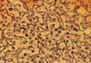 Gomori`s Method for Reticulum Fibers - k018 - Poly Scientific