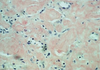 Bennhold's Method for Amyloid (Congo Red) - k002 - Poly Scientific