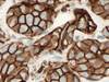 E-cadherin - 790-4497 - Ventana Medical Systems, Inc.