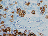 CONFIRM CD45 (LCA) - 760-2505 - Ventana Medical Systems, Inc.
