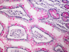 Southgate`s Mucicarmine Method for Mucin - mw008 - Poly Scientific