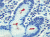 Helicobacter pylori - 760-2645 - Ventana Medical Systems, Inc.