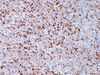 GCDFP-15 - 760-4386 - Ventana Medical Systems, Inc.