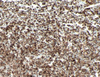 bcl-2 - 790-4604 - Ventana Medical Systems, Inc.
