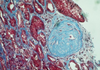 Gomori's One Step Trichrome Method for Connective Tissue (Aniline Blue) - mw022 - Poly Scientific