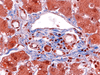 Trichrome II Blue Staining Kit - 860-013 - Ventana Medical Systems, Inc.