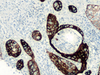 Cytokeratin 17 - 790-4560 - Ventana Medical Systems, Inc.