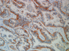 Epithelial Related Antigen - 790-4561 - Ventana Medical Systems, Inc.